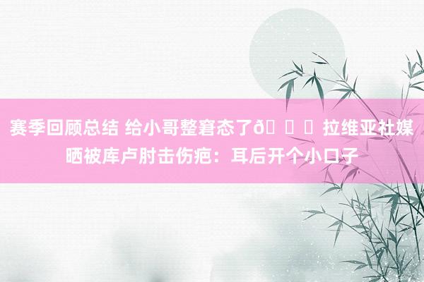 赛季回顾总结 给小哥整窘态了😅拉维亚社媒晒被库卢肘击伤疤：耳后开个小口子